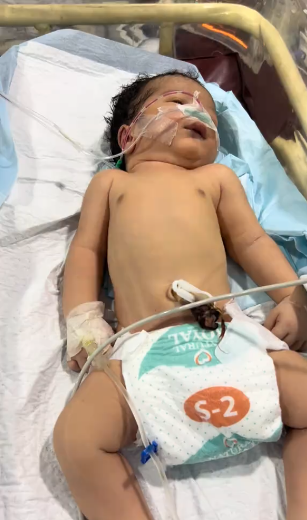 Pedro no leito do hospital, com suporte para respirar